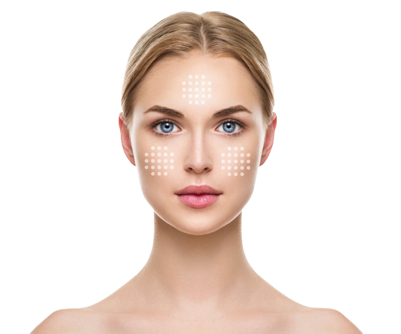 microneedling microneedling